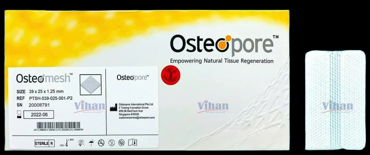 TRỤ MŨI VÁCH NGĂN SINH HỌC PCL - OSTEOMESH DUAL - ảnh sản phẩm nền trong suốt 1