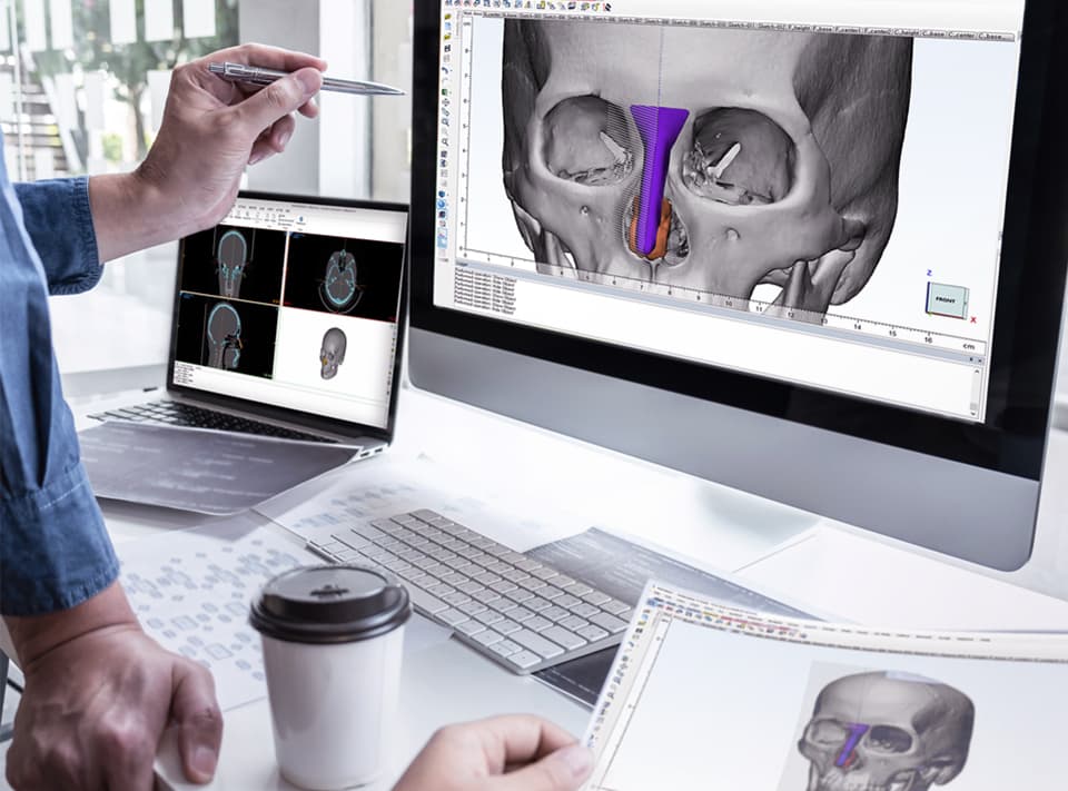 Ảnh lưu trữ bài viết FITme cách mạng hóa phẫu thuật thẩm mỹ bằng cấy ghép 3D tùy chỉnh.