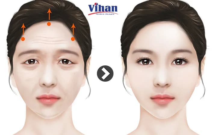Catalogue sản phẩm Vihanmed